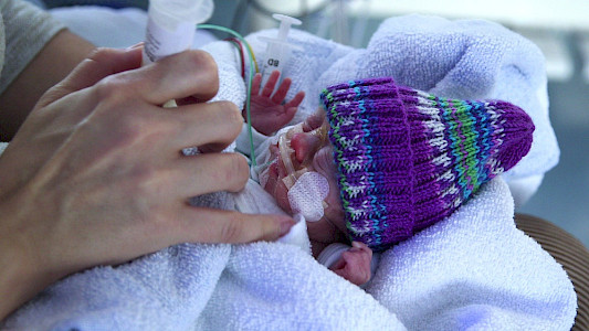 EINE HANDVOLL LEBEN - EXTREME FR&Uuml;HGEBURTEN UND IHRE CHANCEN