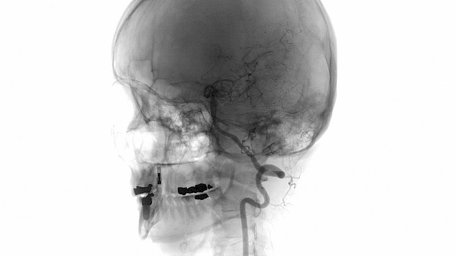 2018 Guerilla Film Koop, Berlin