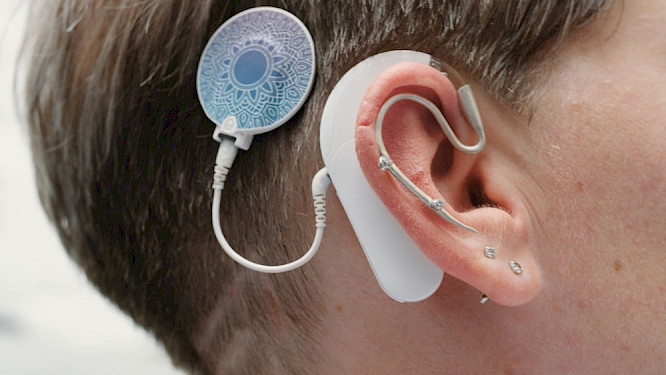 The Wonder of Hearing