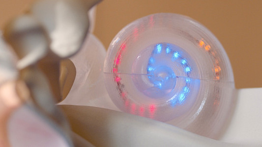 THE WONDER OF HEARING