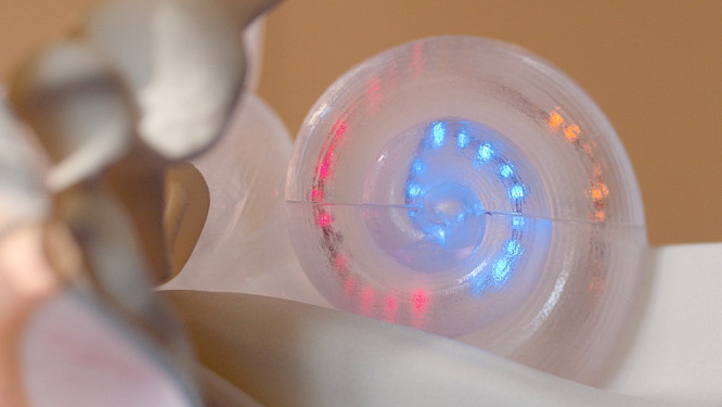 The Wonder of Hearing