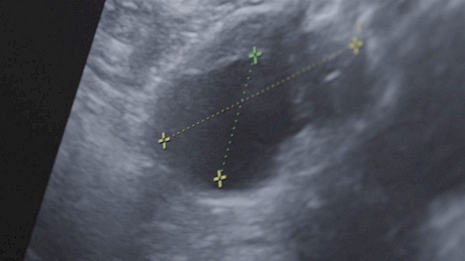 2022 HFF |&nbsp;Luigjina Shkupa