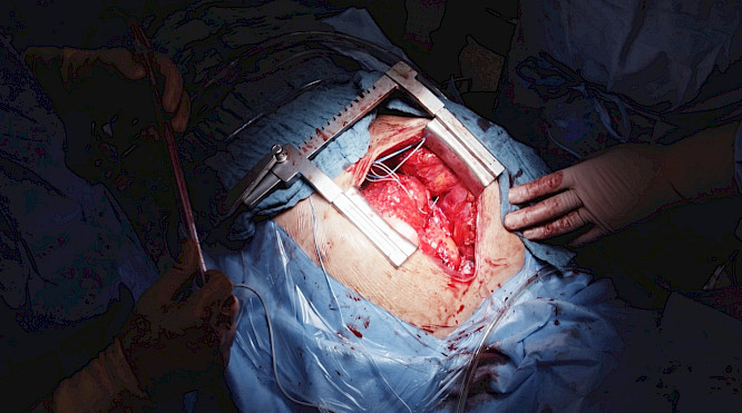 2023 Wolfgang Schmiedt, Lutz Hofmann